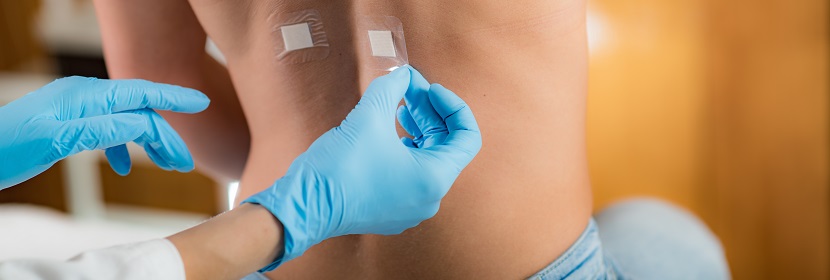 皮膚光變態(tài)反應(yīng)試驗