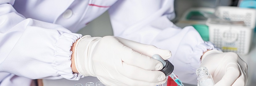 大孔弱堿性苯乙烯系陰離子交換樹(shù)脂檢測(cè)