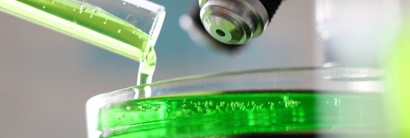 車(chē)用尿素檢測(cè)